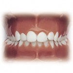 Affordable orthodontic braces in cheltenham